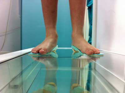 estudio biomecánico de la pisada en niño para ver su pronación y diagnosticar los pies planos