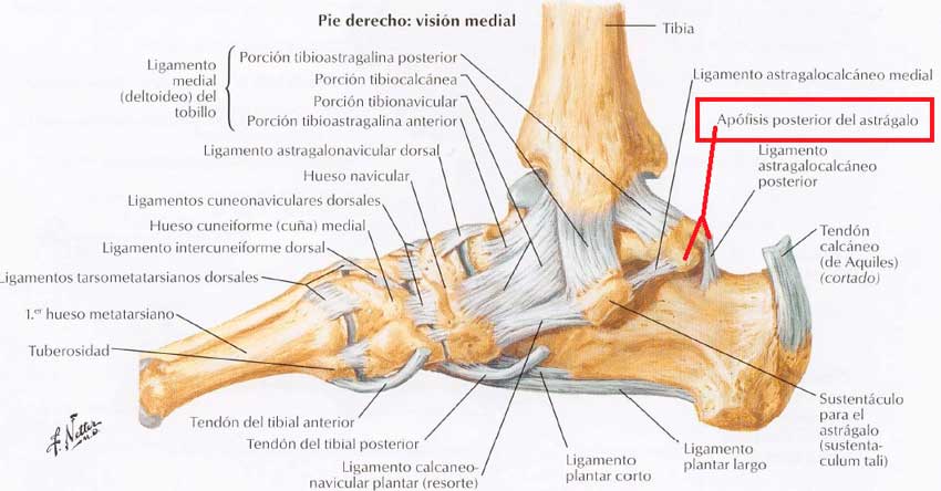 fractura-del-astrágalo anatomía del pie