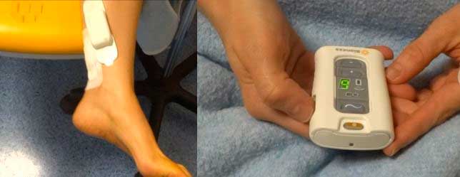 tratamiento para el dolor crónico de talón y pies
