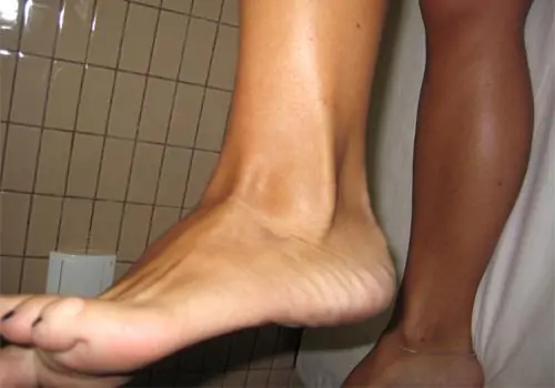 Pie Avanfi tendones peroneos 4 El diagnostico de la tendinitis de los peroneos se centra en la exploración física y por imagen