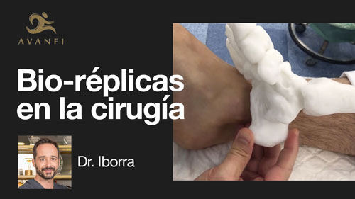 Bio-Réplicas en Cirugía Podológica