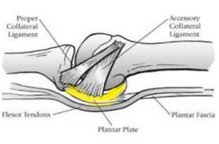 El plato glenoideo o placa plantar se localiza en el pie, concretamente en los dedos, forma parte de la articulación metatarsofalángica en su región inferior