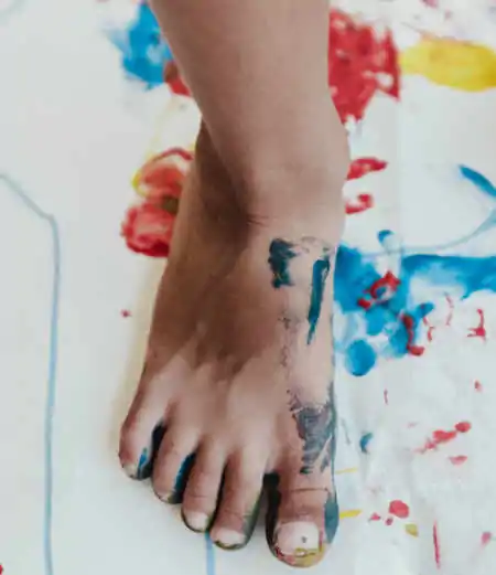 enfermedad de Freiberg tratamiento y cirugía por el Dr. Iborra