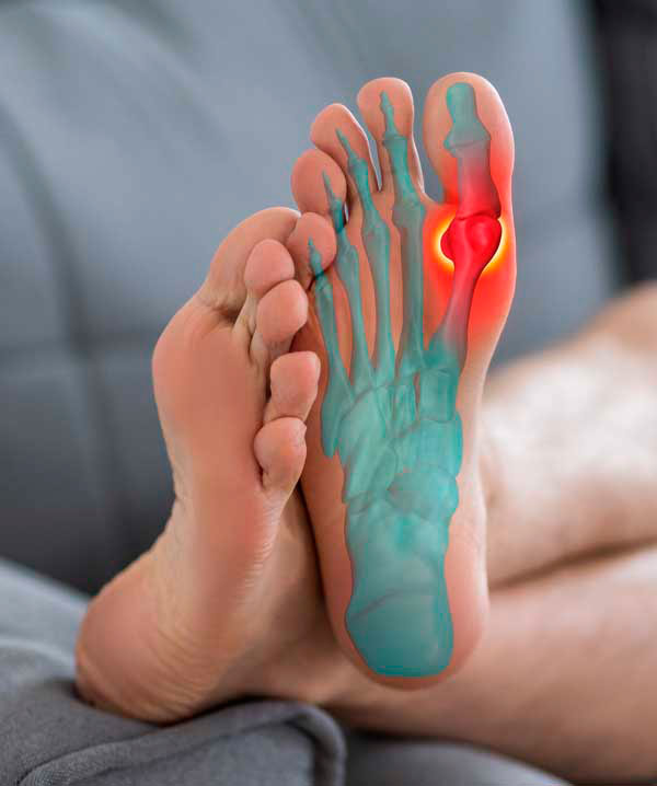 Cirugía ecoguiada ultramínimamente invasiva de la mano