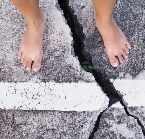 dolor neuropático en los pies o distrofia simpática refleja tratamiento dolor crónico, dolor neuropático o distrofia simpática refleja