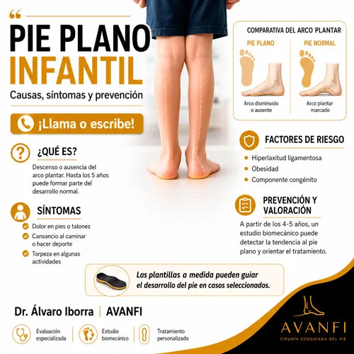 Causas y síntomas del pie plano infantil