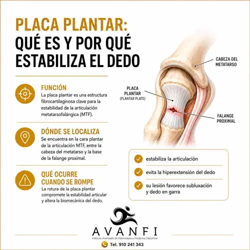 Qué es la placa plantar y cómo estabiliza los dedos