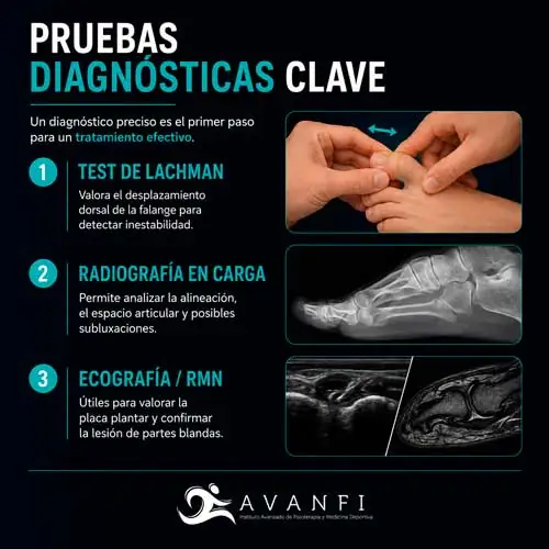 diagnostico rotura de la placa plantar