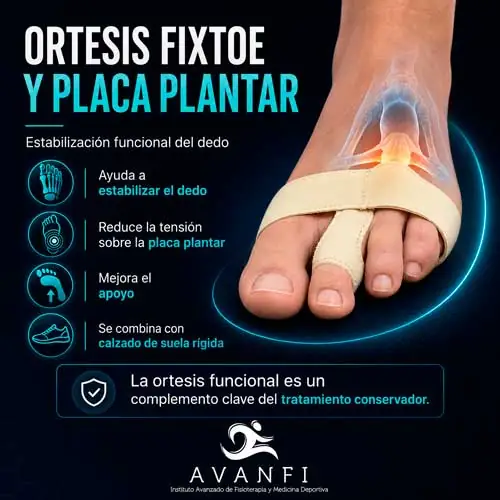 síntomas de la rotura de la placa plantar