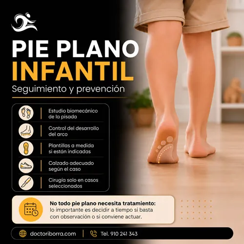 pie plano infantil Que es causas, síntomas y prevención