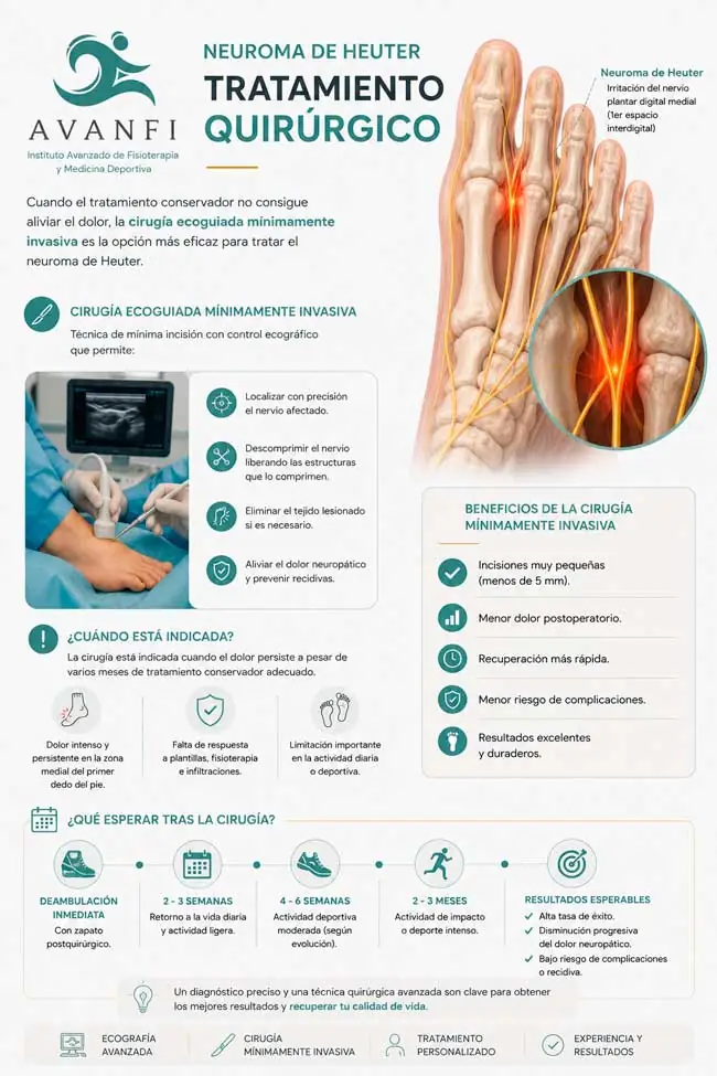 Cirugía del neuroma de Heuter