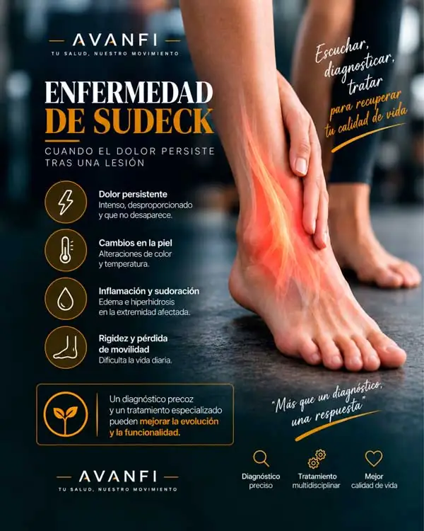 Infografía sobre enfermedad de Sudeck: dolor persistente, edema, cambios de temperatura y rigidez del pie